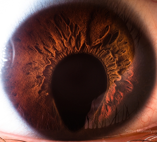 Human Eye