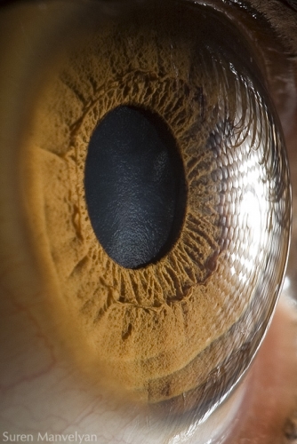 Human Eye