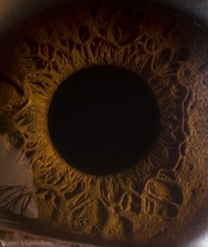 Human Eye