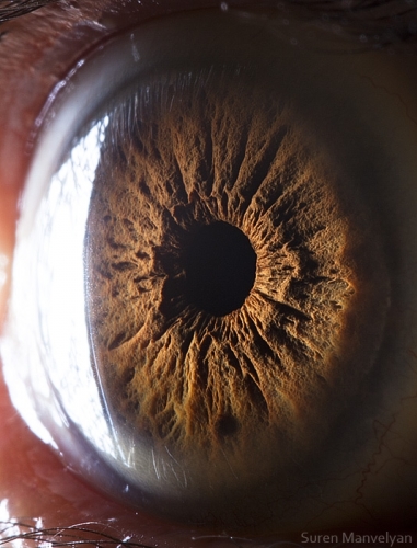 Human Eye