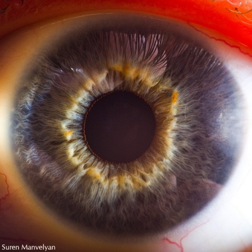 Human Eye