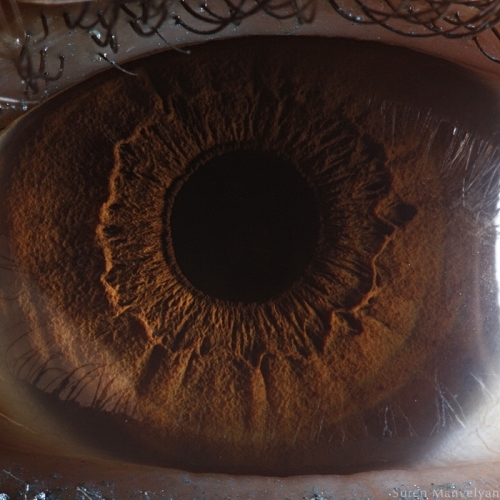 Human Eye