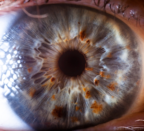 Human Eye