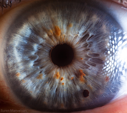 Human Eye