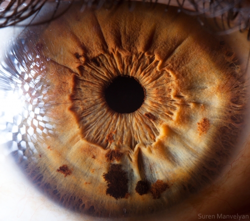 Human Eye