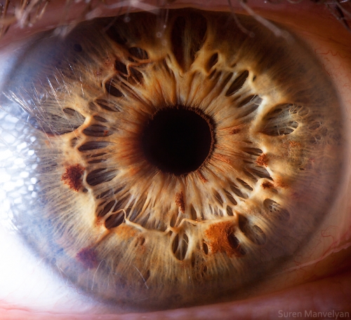 Human Eye