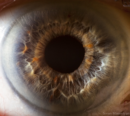 Human Eye