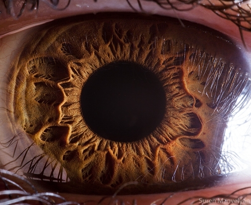 Human Eye 20