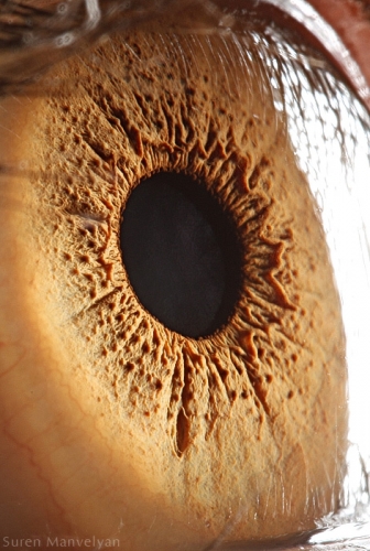 Human Eye 8